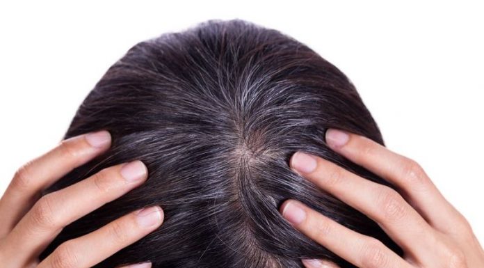 Tìm hiểu về hiện tượng tóc bạc sớm